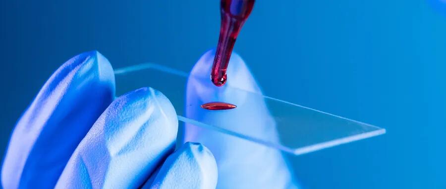 【原創(chuàng)研究】血液制品行業(yè)投研報(bào)告之二：國內(nèi)企業(yè)分離提純工藝仍有較大提升空間